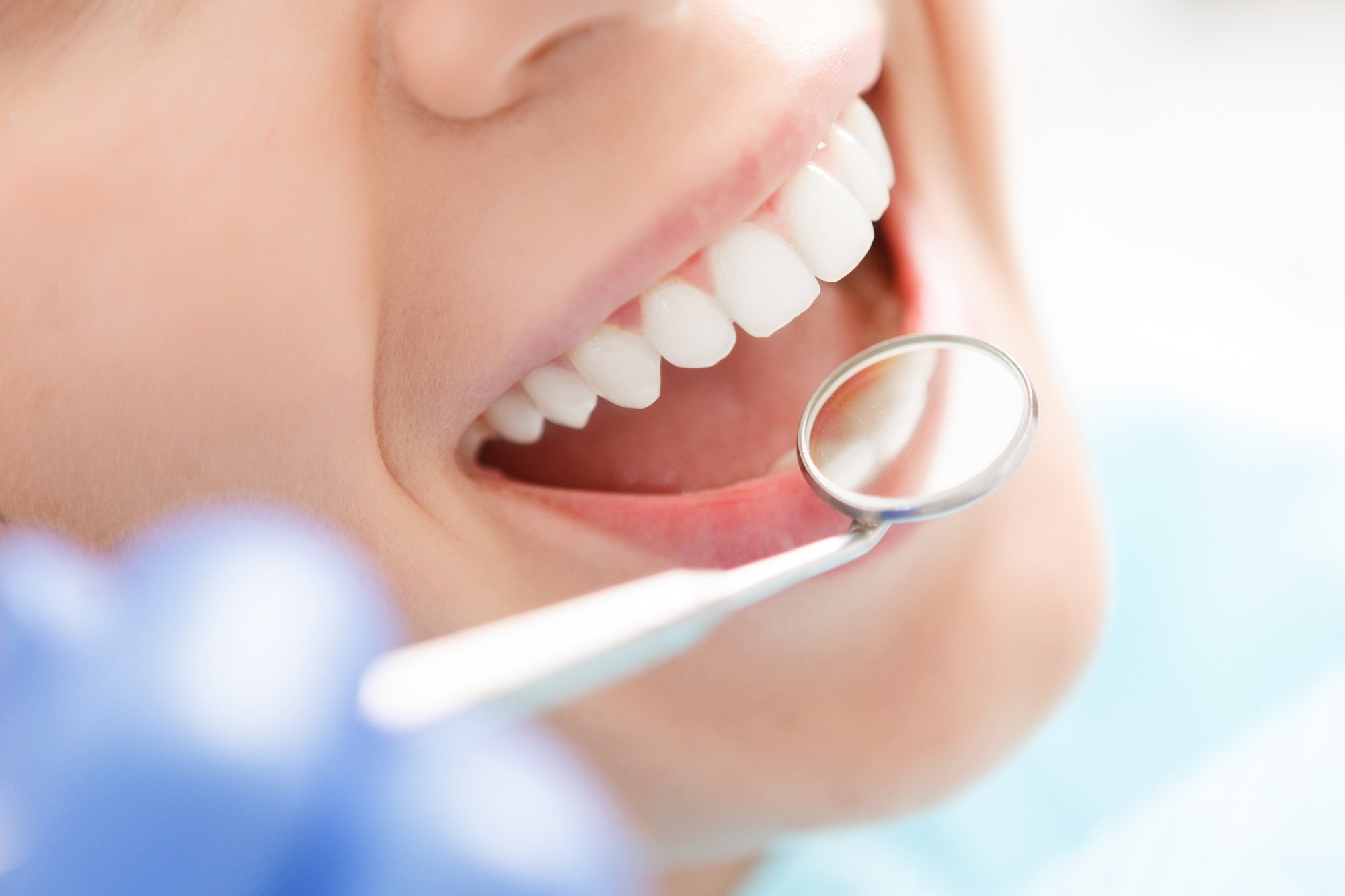 Close-up of healthy teeth with a dental mirror during a dental check-up.