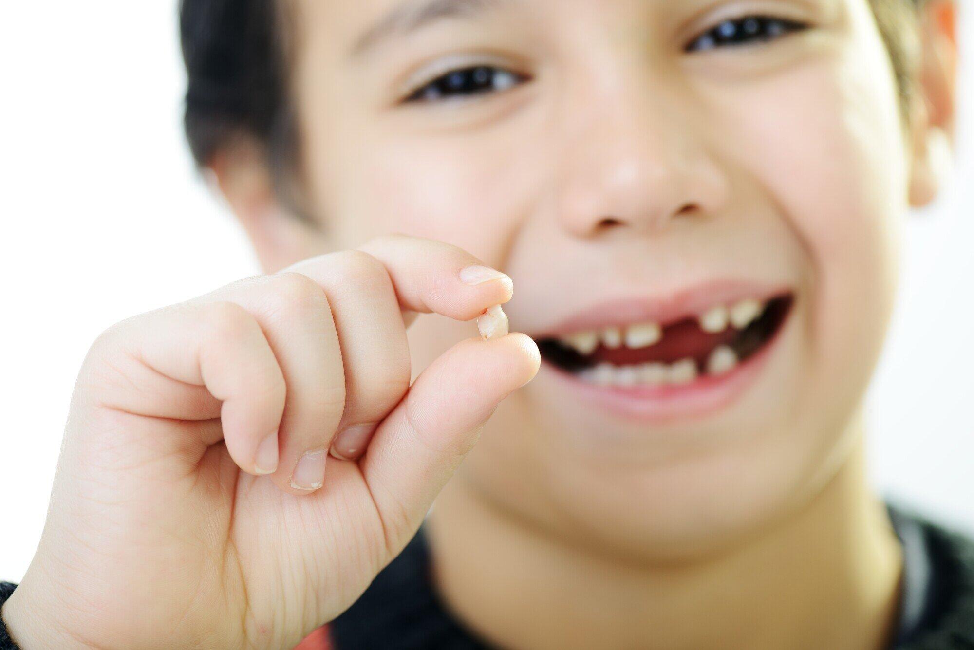 Young boy holding front tooth he lost smiling