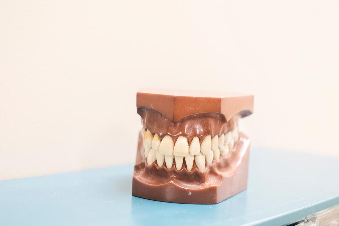 Photo of straight teeth mold on a light blue table