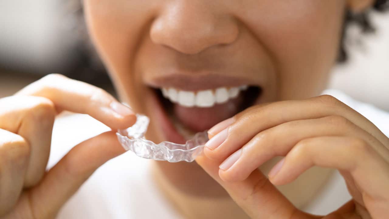 Woman putting a clear night guard on teeth