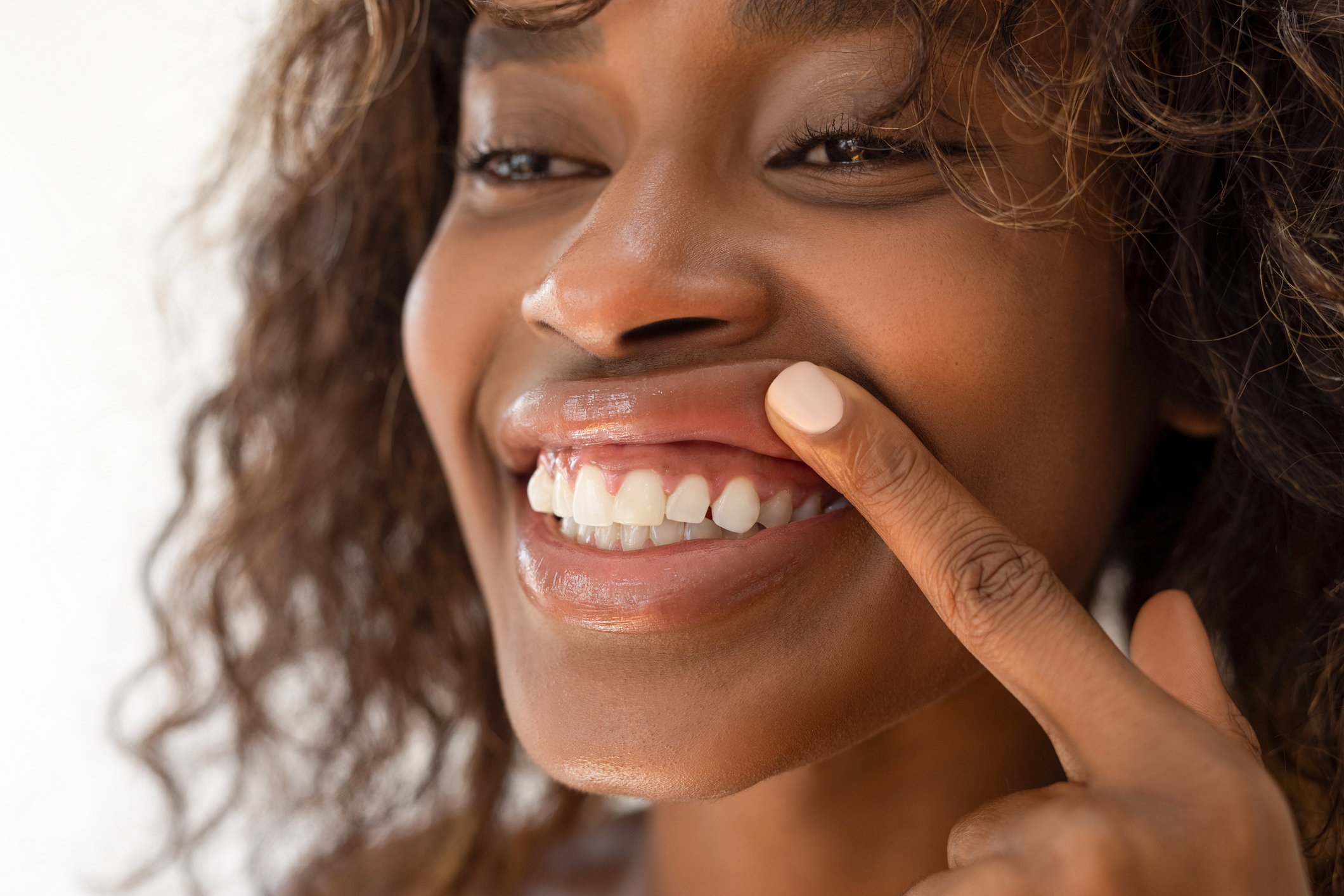 Women pulling up her lip to show teeth and gums
